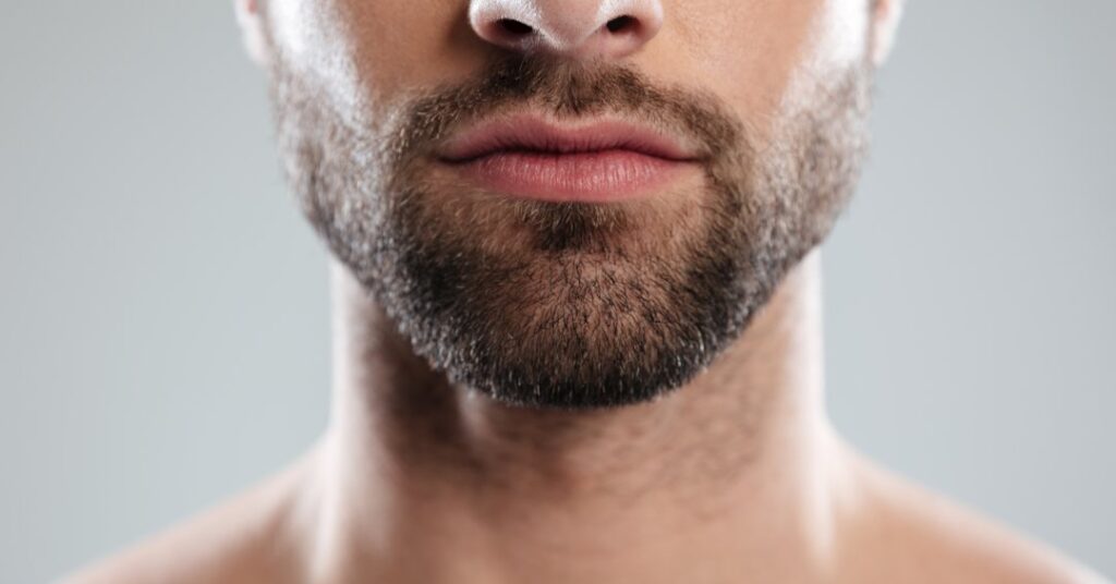 Transplante de barba: como é feito e quais s...