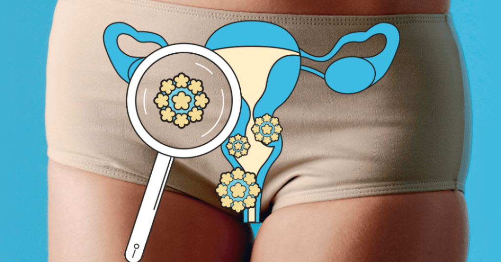 Adeus, papanicolau: SUS implementa teste 100% nacional para detectar HPV