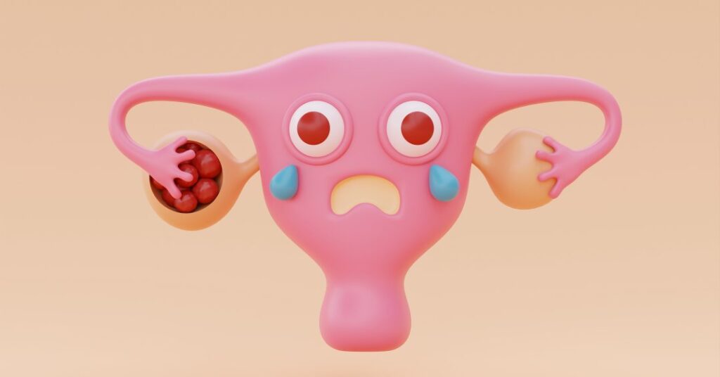 De acne a infertilidade: 5 doenças associadas à síndrome do ovário policístico