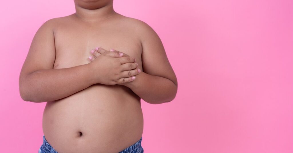 Pela primeira vez, mundo tem mais crianças obesas do que subnutridas