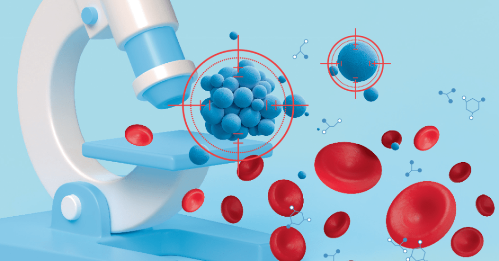 Câncer de bexiga: novo exame permite personalizar melhor o tratamento