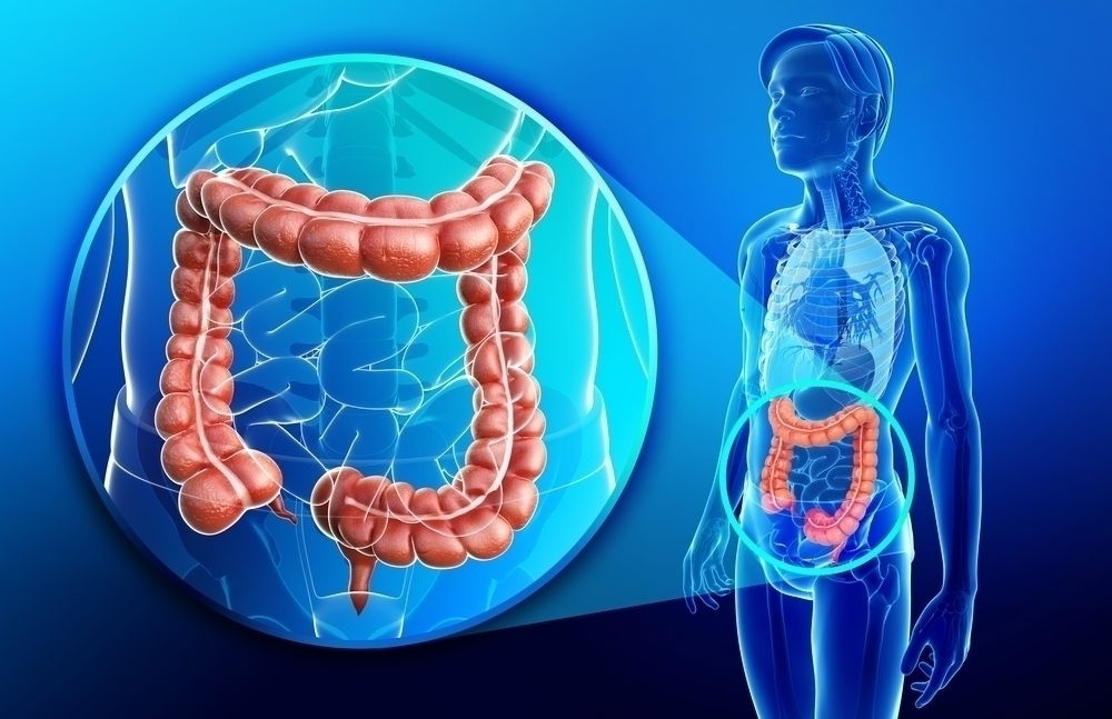 Câncer de intestino tem cura? 4 opções de tratamento