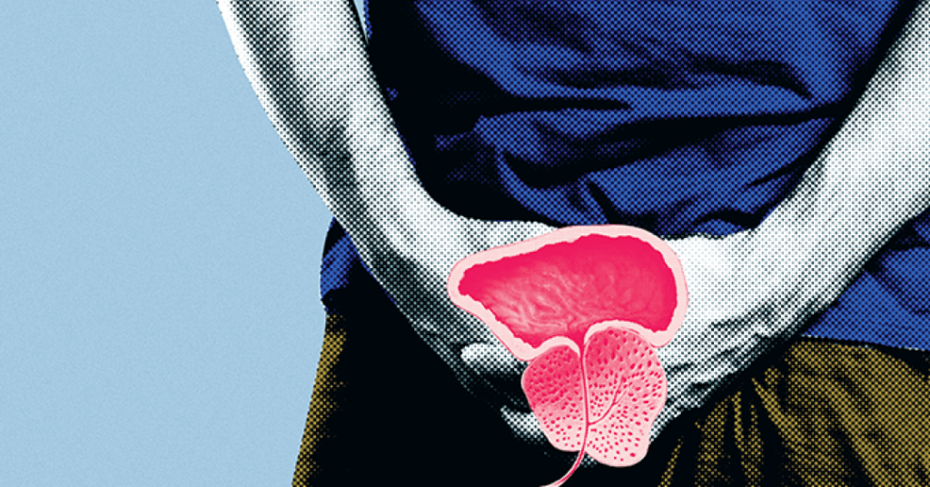 Câncer de próstata: rastreamento com exame de sangue reduz risco de morte