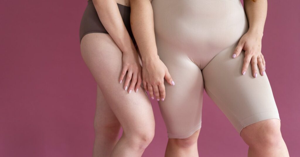 Coxoplastia: o que é o “lifting” de coxas e quando ele é indicado