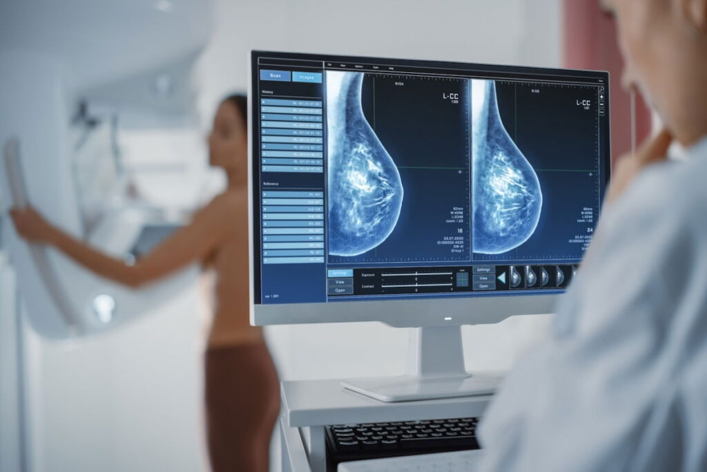 Mamografia digital: para que serve, como é feita (e vantagens)