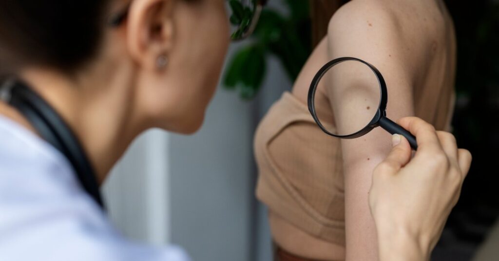 O exame de pele que revela o invisível: diagnóstico rápido de doenças e câncer