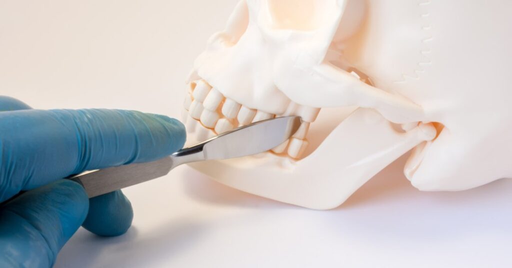 Estudo revela impacto das deformidades faciais na saúde mental