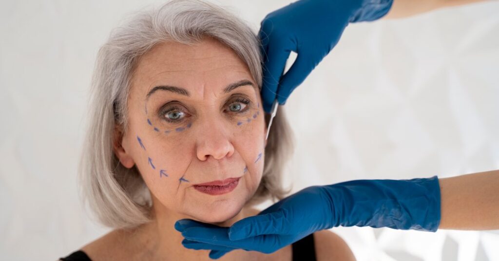 Fios de sustentação: como funciona o procedimento e quais os riscos