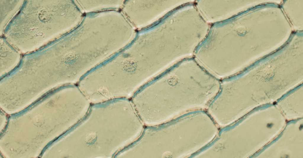 Zoom: lágrimas vão rolar | Veja Saúde