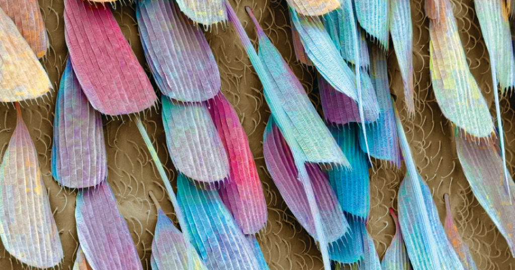 Zoom: vida de inseto | Veja Saúde