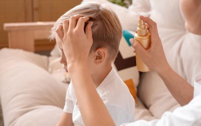 6 remédios caseiros para piolhos (e como fazer)