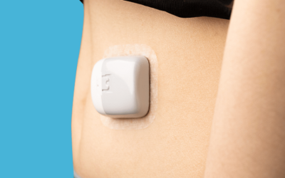 A menor bomba de insulina do mundo chega ao Brasil