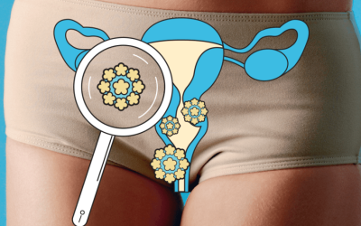 Adeus, papanicolau: SUS implementa teste 100% nacional para detectar HPV