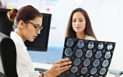 Ataque Isquêmico Transitório (AIT): o que é, sintomas e tratamento