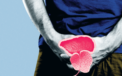 Câncer de próstata: rastreamento com exame de sangue reduz risco de morte