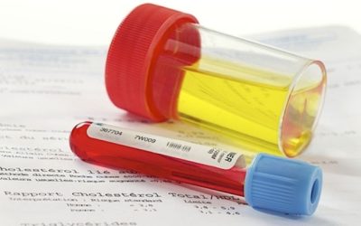 Clearance de creatinina: o que é, valores e calculadora