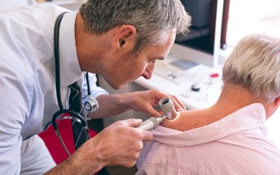 Cobreiro: o que é, sintomas, causas e tratamento