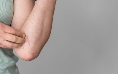 Coceira no corpo? Conheça 5 motivos frequentes