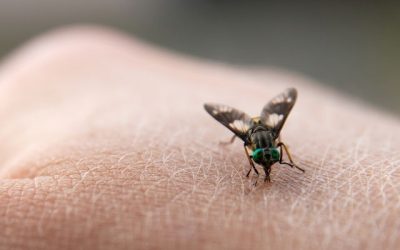 Como tirar berne: 4 opções caseiras (e como evitar)