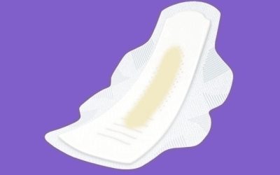 Corrimento branco: 7 causas comuns (e o que fazer)