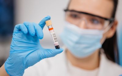 Creatinina: o que é, quando fazer o exame (e valores normais)