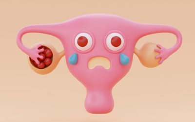 De acne a infertilidade: 5 doenças associadas à síndrome do ovário policístico