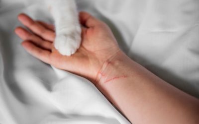 Doença da arranhadura do gato: o que é, sintomas, causa e tratamento