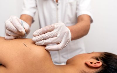 Dry needling: o que é, para que serve e como é feito