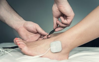 Eletroneuromiografia: o que é, para que serve e como é feito