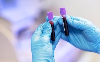 Eritrócitos altos no exame de sangue: entend...