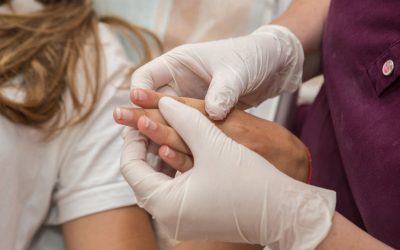 Especialistas em disidrose: qual médico consultar?