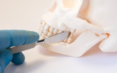 Estudo revela impacto das deformidades faciais na saúde mental