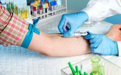 Flebotomia: o que é, quando é indicada (e como é feita)