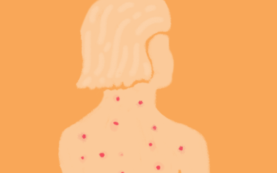 Governo barra vacina da herpes-zóster no SUS: saiba a quem é indicada e quanto custa na rede privada