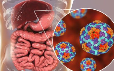 Hepatite A: conheça os sintomas e as formas de transmissão, tratamento e prevenção