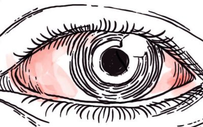 Herpes ocular: o que é, quais as causas e os...