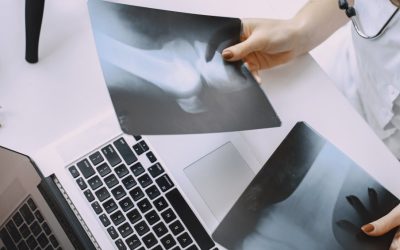 Laudos a distância ampliam acesso a exames