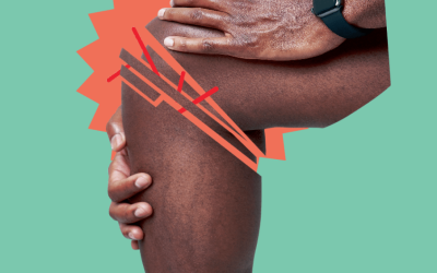 Liberte-se da artrose: informação e atividade física são chaves do tratamento