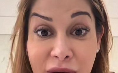 Maíra Cardi mostra sobrancelha torta após aplicação de botox; entenda