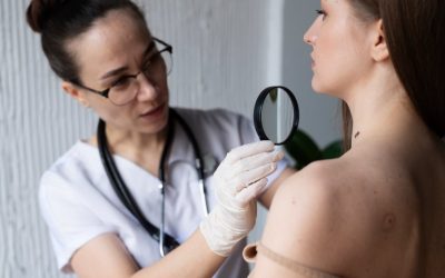 Melanoma: conheça o tipo mais agressivo de c...