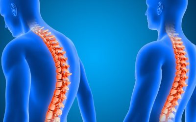 Mobilidade de coluna: veja 5 exercícios para evitar dor nas costas