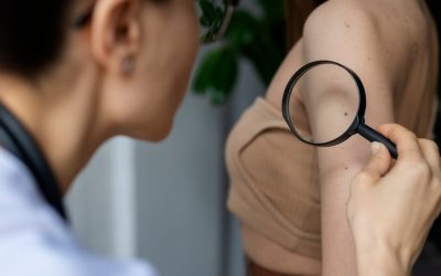 O exame de pele que revela o invisível: diagnóstico rápido de doenças e câncer