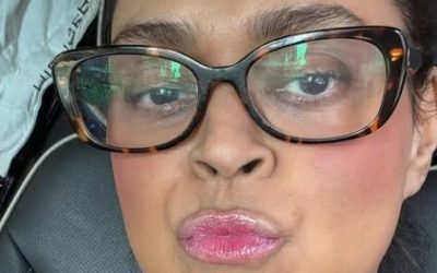 Preta Gil inicia tratamento experimental nos...