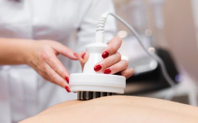 Radiofrequência estética funciona? Quais os...