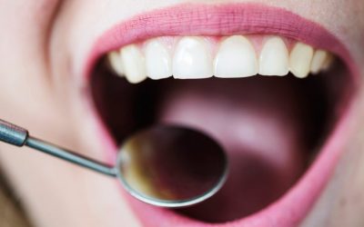 “Salvei minha vida em um checkup bucal”