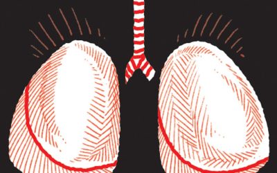 Sotatercept: Novo medicamento reduz risco de morte por hipertensão arterial pulmonar