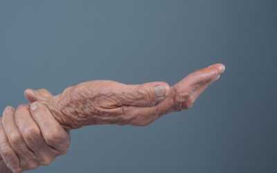 Tremor essencial: saiba o que é, como diferenciar do Parkinson, e os tratamentos