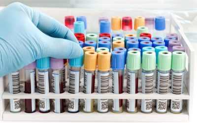 Triglicerídeos baixos: o que significa (e o que fazer)