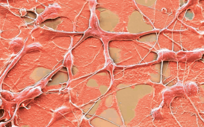 Zoom: a inteligência natural | Veja Saúde